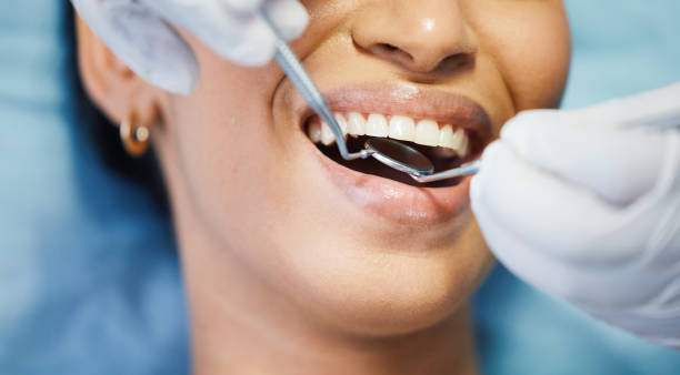 Best Emergency Tooth Extraction in Bard College, NY
