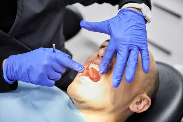 Best Emergency Tooth Extraction in Bard College, NY